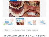 Teath whitening kit
